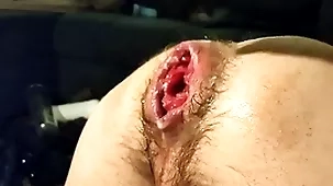 Unassisted fisting my left alone fissure with the addition of prolapse:)
