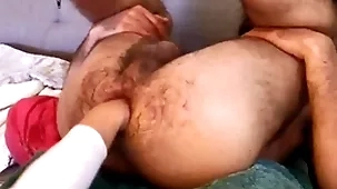 Fist anal scratch b ill old lady femme #2